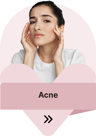 Acne